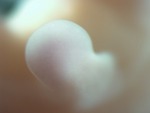 EMAGE:27564