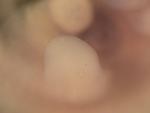 EMAGE:27593