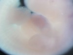 EMAGE:27679