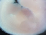 EMAGE:27679