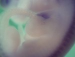 EMAGE:27703