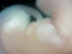 EMAGE:27703