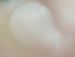 EMAGE:27703