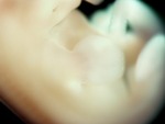 EMAGE:27706