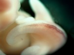 EMAGE:27706
