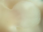EMAGE:27706