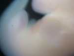 EMAGE:27708