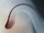 EMAGE:27708