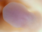 EMAGE:27746