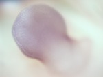 EMAGE:27761
