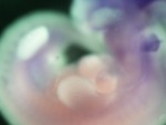 EMAGE:27773