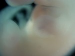 EMAGE:27779
