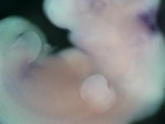 EMAGE:27779