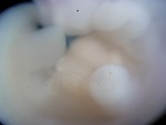 EMAGE:27779