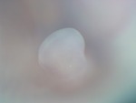 EMAGE:27779