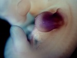 EMAGE:27809