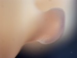 EMAGE:27809