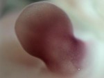 EMAGE:27809