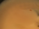 EMAGE:27809