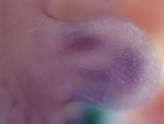 EMAGE:27845
