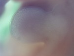 EMAGE:27896