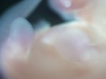 EMAGE:27927