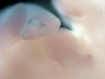 EMAGE:27944
