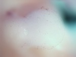 EMAGE:27944