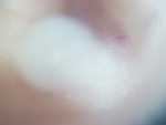EMAGE:27944