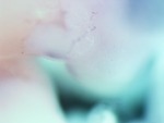 EMAGE:27944