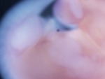 EMAGE:28013