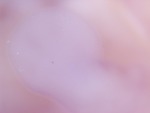 EMAGE:28013