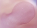 EMAGE:28013