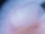 EMAGE:28013