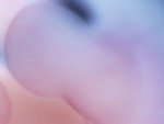 EMAGE:28013