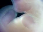 EMAGE:28025
