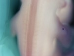 EMAGE:28025