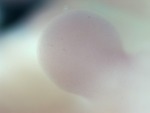 EMAGE:28025