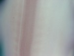 EMAGE:28025