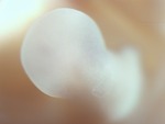 EMAGE:28044