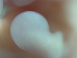 EMAGE:28048