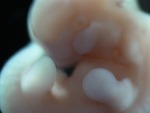 EMAGE:28052