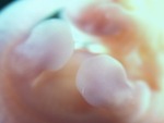 EMAGE:28078
