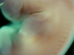 EMAGE:28081