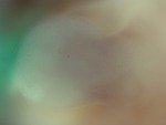 EMAGE:28081