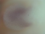 EMAGE:28085