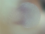 EMAGE:28085
