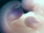 EMAGE:28116