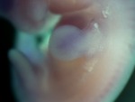 EMAGE:28133