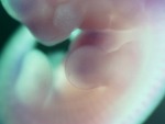 EMAGE:28149